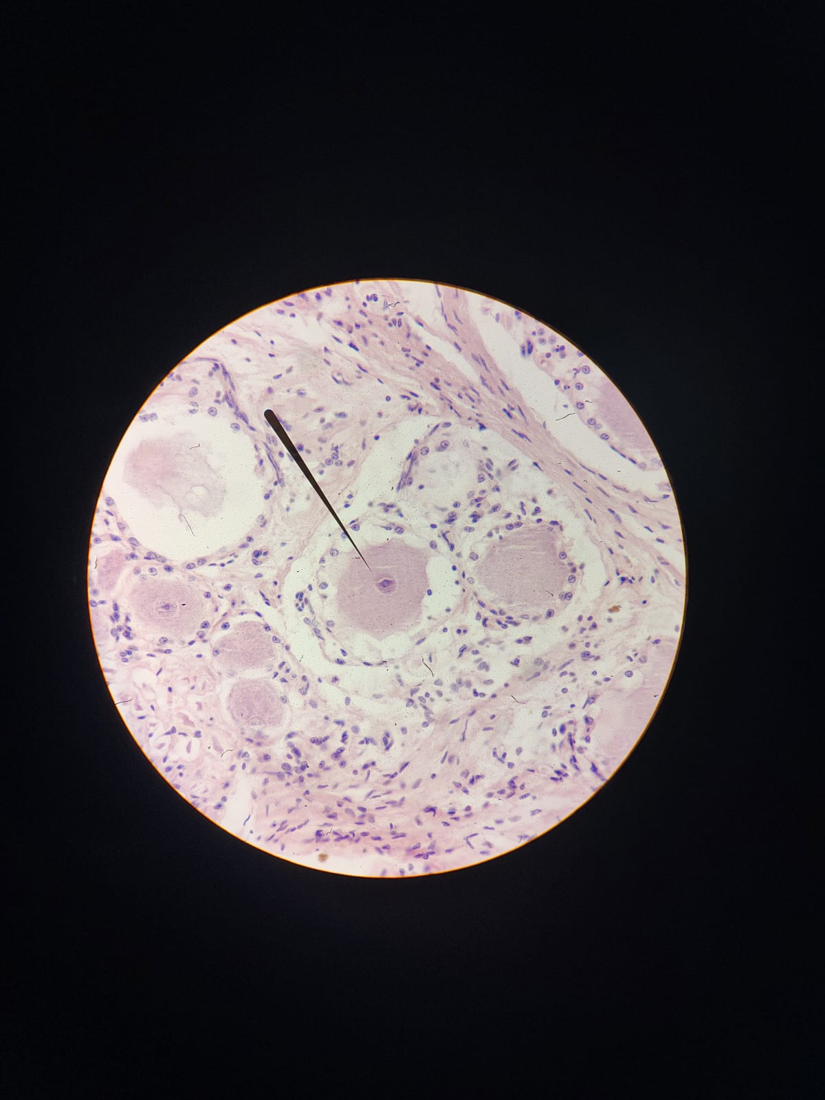 Pericário de um neurônio pseudounipolar sensitivo localizado no gânglio da raiz dorsal de um nervo espinal. Observe as células satélites fornecendo sustentação para esse neurônio.