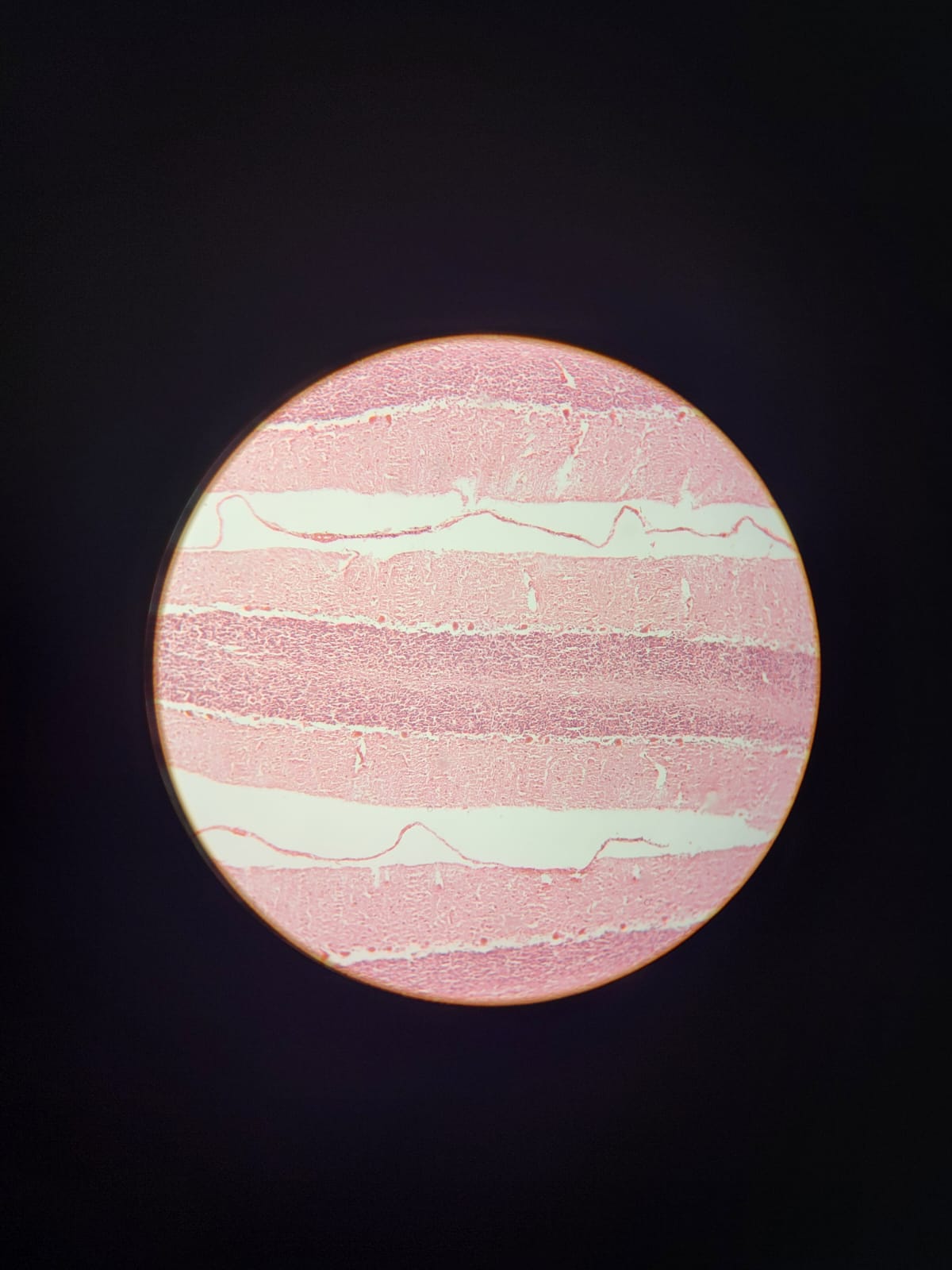 Fotomicrografia de uma circunvolução cerebelar. Note que é possível discernir as meninges.