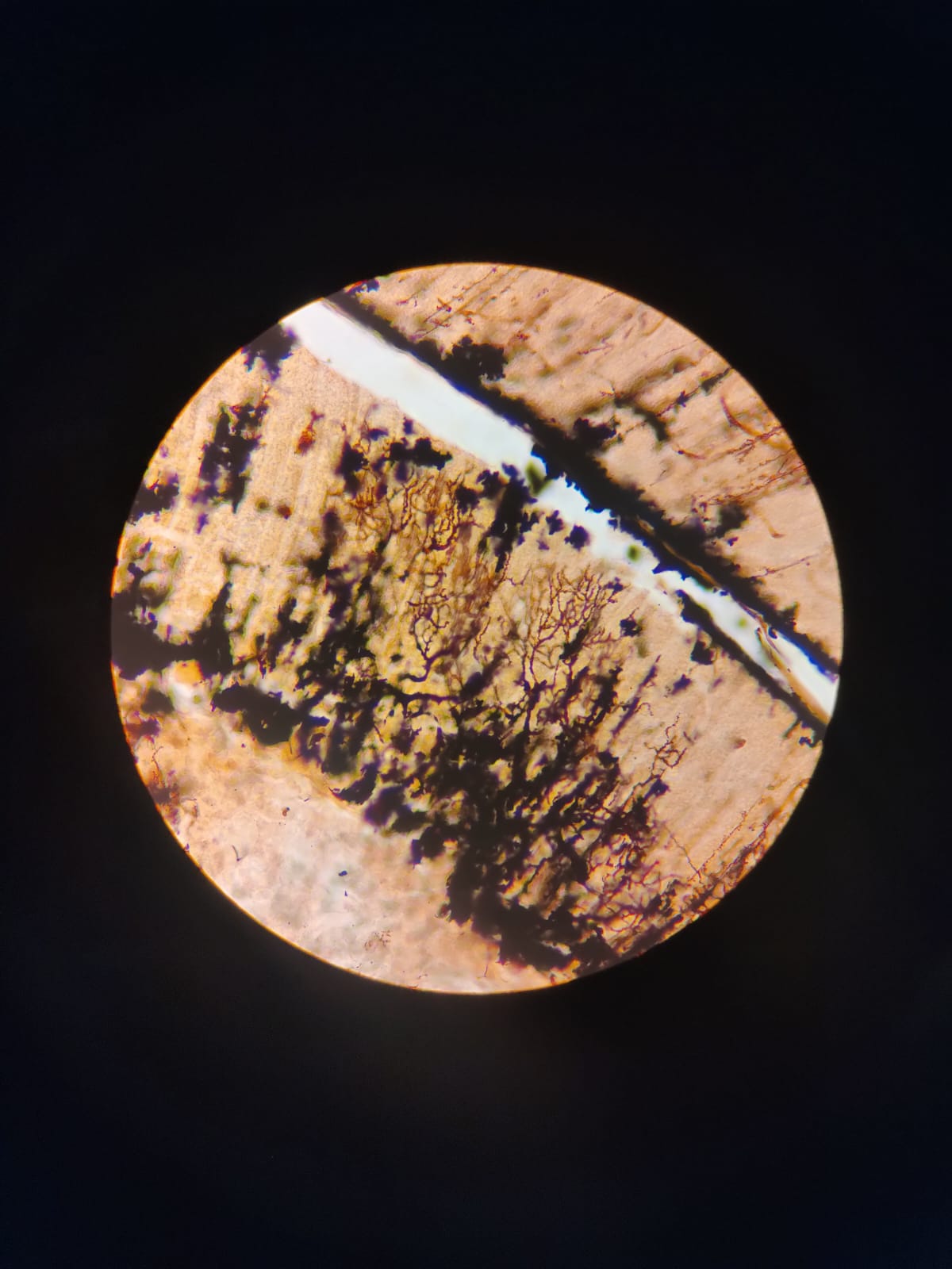 Corte histológico da região cortical do cérebro (corado pela prata).