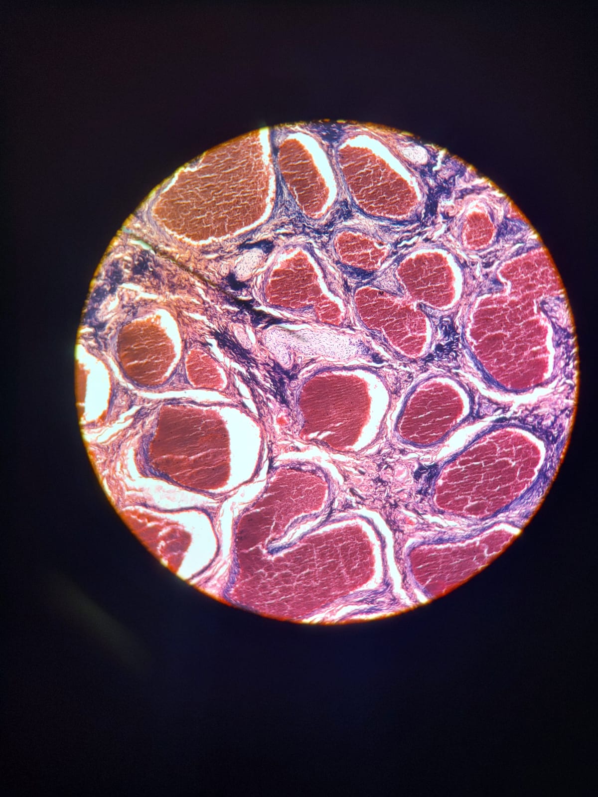 Componente neural de um feixe neurovascular.
