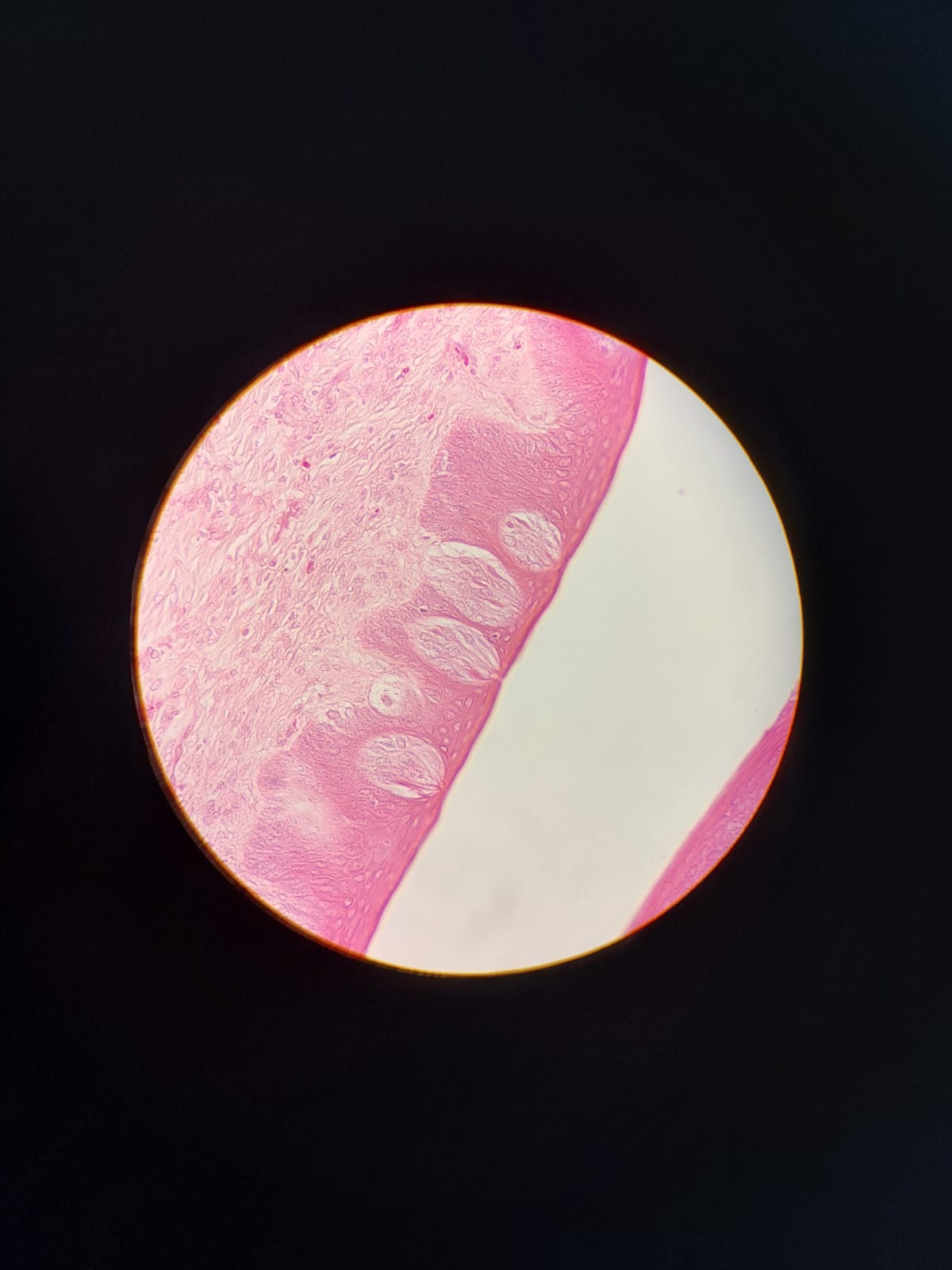 Botões gustativos presentes na superfície lateral das papilas circunvaladas. Observe a região do poro gustativo, as células gustativas, as células sustentaculares e a região de sinapse com neurônios sensitivos.