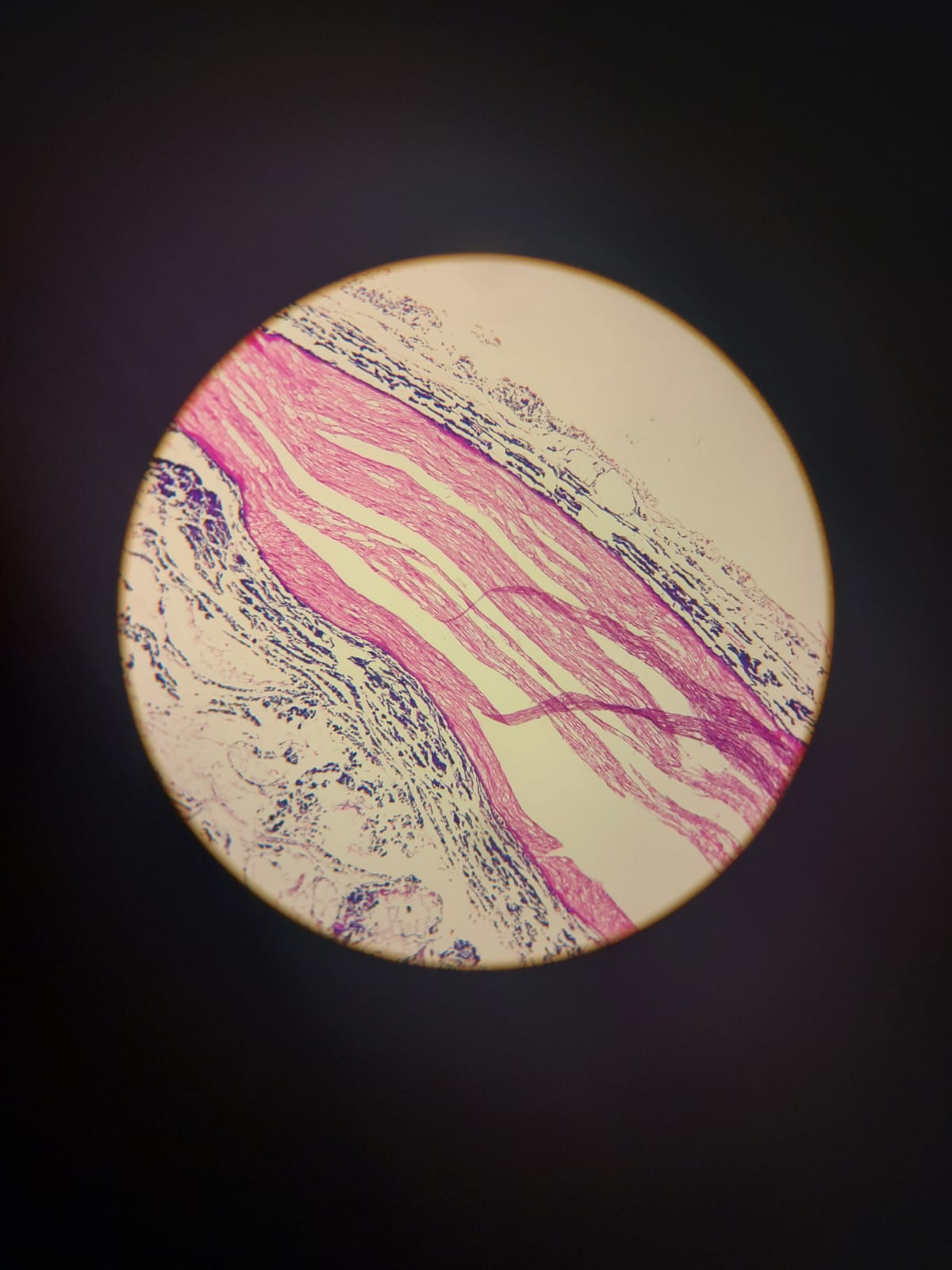 Aspecto de um nervo periférico à microscopia de luz.
